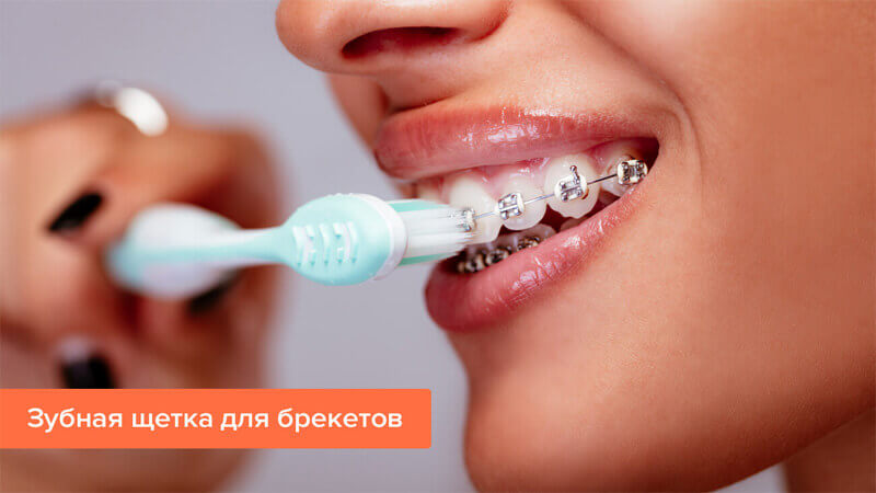 Щетка для чистки брекетов Щетка для чистки зубов с брекетами